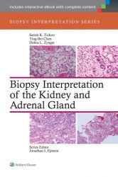 Biopsy Interpretation of the Kidney e Adrenal Gland