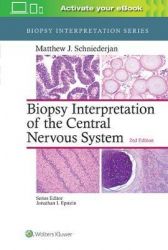 Biopsy Interpretation of the Central Nervous System