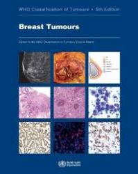 Breast Tumours, WHO Classification of Tumours, 5th Edition, Volume 2