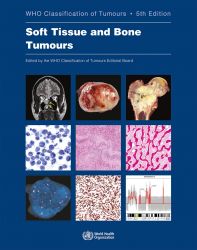 Soft Tissue and Bone Tumours WHO Classification of Tumours, 5th Edition, Volume 3