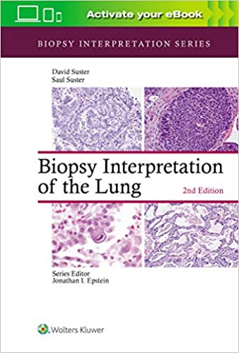 Biopsy Interpretation of the Lung Imagem 1
