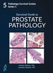 Survival Guide to Prostate Pathology
