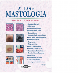 Atlas da Mastologia - Imagens Comentadas