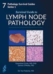 Survival Guide to Lymph Node Pathology
