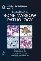 Survival Guide to Bone Marrow Pathology