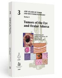 Tumors of the Eye and Ocular Adnexa (5F03)