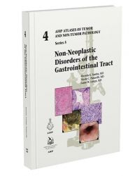 Non-Neoplastic Disorders of the Gastrointestinal Tract (5F04)
