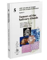 Tumors of the Salivary Glands (5F05)