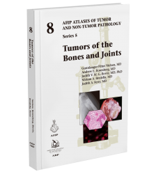 Tumors of the Bones and Joints (5F08)