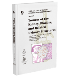 Tumors of the Kidney, Bladder, and Related Urinary Structures (5F09)