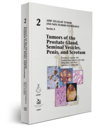 Tumors of the Prostate Gland, Seminal Vesicles, Penis,  and Scrotum (5F02)