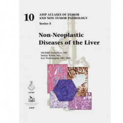 Non-Neoplastic Diseases of the Liver (10F5)